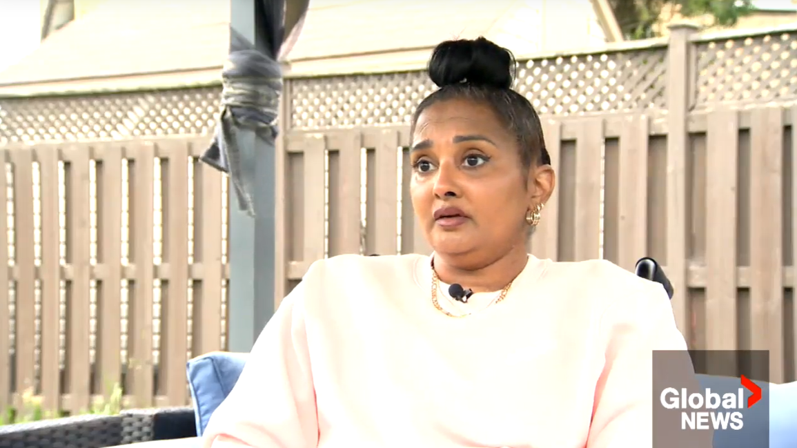 Quebec woman loses hands and legs after rare infection led to septic shock
